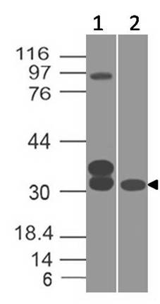 Monoclonal Antibody to Glutamate-Cysteine Ligase Regulatory Subunit /GCLM  (Clone: ABM2F9.1A7)