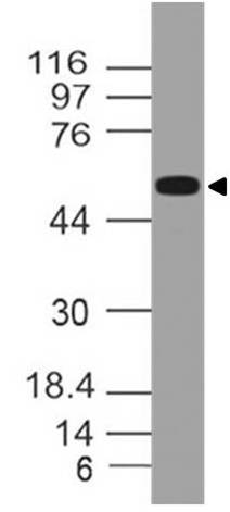 Monoclonal Antibody to Lck (Clone: ABM18H9)