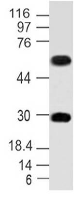 Monoclonal Antibody to MITF (Clone: ABM1H91)