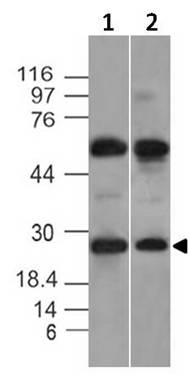 Monoclonal antibody to KCHIP1 (Clone: ABM20A1)