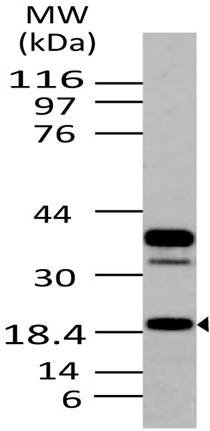 Monoclonal Antibody to AGR2 (Clone: ABM22E6)