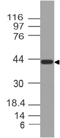 Monoclonal Antibody to Wnt5A (Clone: ABM2A39)