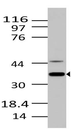 Monoclonal Antibody to NIFK (Clone: ABM29H6)