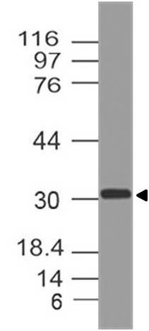 Monoclonal Antibody to Myogenin (Clone: ABM30A5)