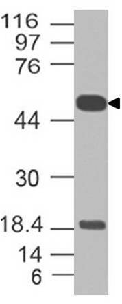 Monoclonal Antibody to SOX10 (Clone: ABM42D7)