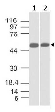 Monoclonal Antibody to SOX10 (Clone: ABM4E24)