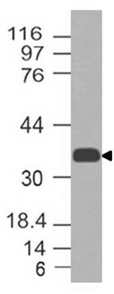 Monoclonal antibody to CCR2 (Clone: ABM58F2)