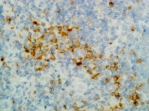 Biotinylated Recombinant Rabbit Monoclonal Antibody  to Human gamma heavy chain (Clone: RM116)(Discontinued)