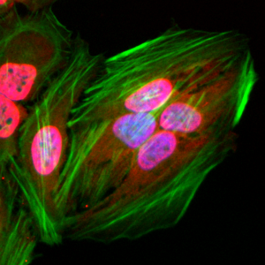 Recombinant Rabbit Monoclonal Antibody  to Acetylated -Lysine (Clone: RM101)(Discontinued)