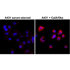 Recombinant Rabbit Monoclonal Antibody  to Phosphothreonine (Clone: RM102)(Discontinued)