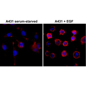 Recombinant Rabbit Monoclonal Antibody  to Phosphotyrosine (Clone: RM111)(Discontinued)