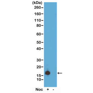 Recombinant Rabbit Monoclonal Antibody  to Phospho-Histone H3 (Ser10) (Clone: RM163)(Discontinued)