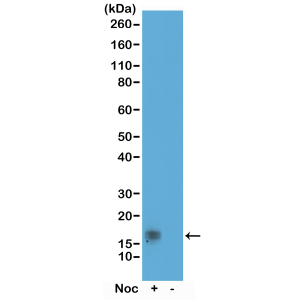 Recombinant Rabbit Monoclonal Antibody  to Phospho-Histone H3 (Thr11) (Clone: RM164)(Discontinued)