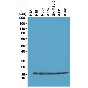 Recombinant Rabbit Monoclonal Antibody  to Histone H2B (Clone: RM230)(Discontinued)