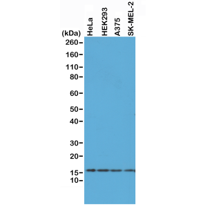 Recombinant Rabbit Monoclonal Antibody  to Histone H2AX (Clone: RM214)(Discontinued)