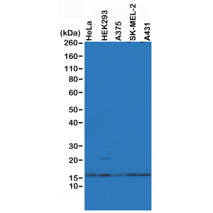 Recombinant Rabbit Monoclonal Antibody  to Histone H2AZ (Clone: RM215)(Discontinued)