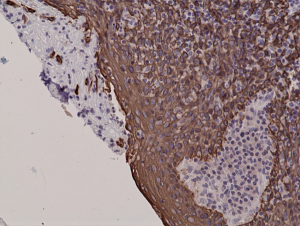 Recombinant Rabbit Monoclonal Antibody  to CK5 (Cytokeratin 5) (Clone: RM226)(Discontinued)