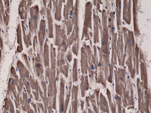 Recombinant Rabbit Monoclonal Antibody  to Acetyl-CoA Carboxylase 1 (Clone: RM232)(Discontinued)