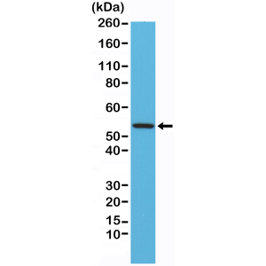 Recombinant Rabbit Monoclonal Antibody  to Desmin (DESM) (Clone: RM234)(Discontinued)