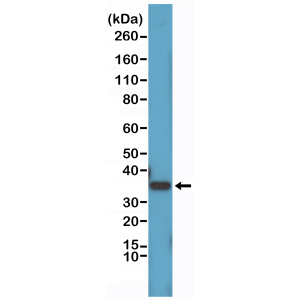 Recombinant Rabbit Monoclonal Antibody  to Cyclin D1 (CCND1)(Clone: RM241)(Discontinued)