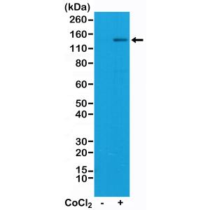 Recombinant Rabbit Monoclonal Antibody  to HIF-1-alpha  (HIF1A) (Clone: RM242)(Discontinued)