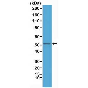 Recombinant Rabbit Monoclonal Antibody  to GFAP (Glial Fibrillary Acidic Protein) (Clone: RM246)(Discontinued)