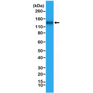 Recombinant Rabbit Monoclonal Antibody  to CD31 (PECAM-1) (Clone: RM247)(Discontinued)