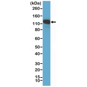 Recombinant Rabbit Monoclonal Antibody  to CD146, MCAM, MUC18 (Clone: RM249)(Discontinued)