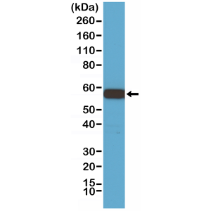 Recombinant Rabbit Monoclonal Antibody  to Akt1  (Clone: RM252)(Discontinued)