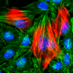 Recombinant Rabbit Monoclonal Antibody  to Calponin-1 (Clone: RM262)(Discontinued)