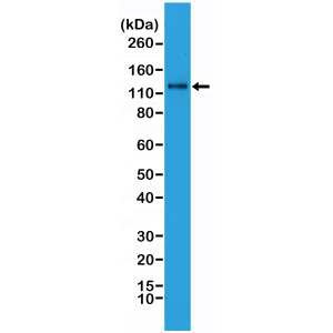 Recombinant Rabbit Monoclonal Antibody  to N-Cadherin, CADH2, CDH2, Cadherin-2 (Clone: RM259)(Discontinued)