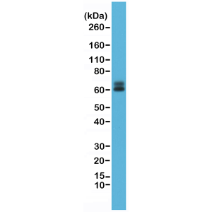 Recombinant Rabbit Monoclonal Antibody  to Paxillin (Clone: RM256)(Discontinued)