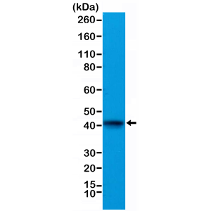 Recombinant Rabbit Monoclonal Antibody  to Alpha Cardiac Actin (ACTC1) (Clone: RM257)(Discontinued)