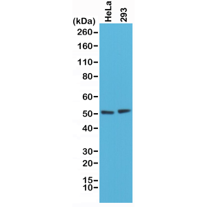 Recombinant Rabbit Monoclonal Antibody  to PTEN (Clone: RM265)(Discontinued)