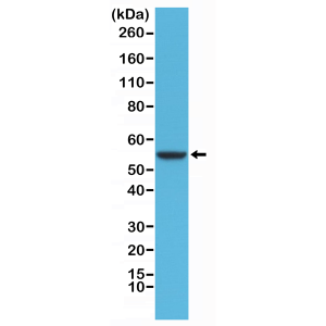 Recombinant Rabbit Monoclonal Antibody  to CK8 (Cytokeratin-8) (Clone: RM266)(Discontinued)