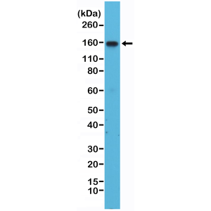 Recombinant Rabbit Monoclonal Antibody  to Integrin alpha 4 (ITGA4)  (Clone: RM268)(Discontinued)