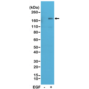 Recombinant Rabbit Monoclonal Antibody  to Phospho-EGFR (Y1173) (Clone: RM269)(Discontinued)