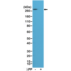 Recombinant Rabbit Monoclonal Antibody  to Phospho Acetyl CoA Carboxylase (S79) (ACC1) (Clone: RM270)(Discontinued)