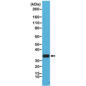 Recombinant Rabbit Monoclonal Antibody  to CD20 (Clone: RM272)(Discontinued)