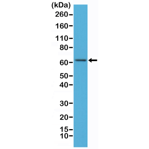 Recombinant Rabbit Monoclonal Antibody  to NFkB p65 (Clone: RM273)(Discontinued)