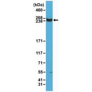 Recombinant Rabbit Monoclonal Antibody  to mTOR (Clone: RM274)(Discontinued)