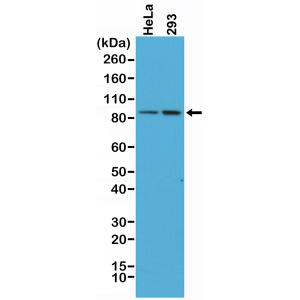 Recombinant Rabbit Monoclonal Antibody  to Beta-Catenin 1 (CTNNB1) (Clone: RM276)(Discontinued)