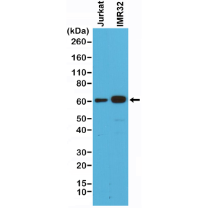 Recombinant Rabbit Monoclonal Antibody  to Smad4 (Clone: RM277)(Discontinued)