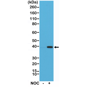 Recombinant Rabbit Monoclonal Antibody  to Aurora-B (AURKB) (Clone: RM278)(Discontinued)