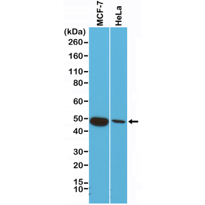 Recombinant Rabbit Monoclonal Antibody  to CK18 (Cytokeratin-18) (Clone: RM279)(Discontinued)