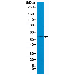 Recombinant Rabbit Monoclonal Antibody  to GFAP (C-Terminal) (Clone: RM282)(Discontinued)