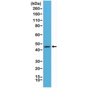 Recombinant Rabbit Monoclonal Antibody  to CK20  (Cytokeratin-20) (Clone: RM283)(Discontinued)