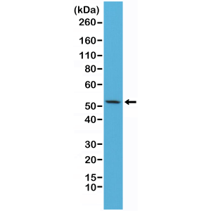 Recombinant Rabbit Monoclonal Antibody  to CK7 (Cytokeratin-7) (Clone: RM284)(Discontinued)