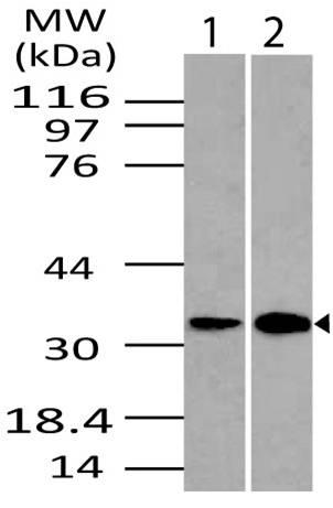 Polyclonal Antibody to DRAM