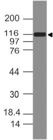 Polyclonal Antibody to DAAM1